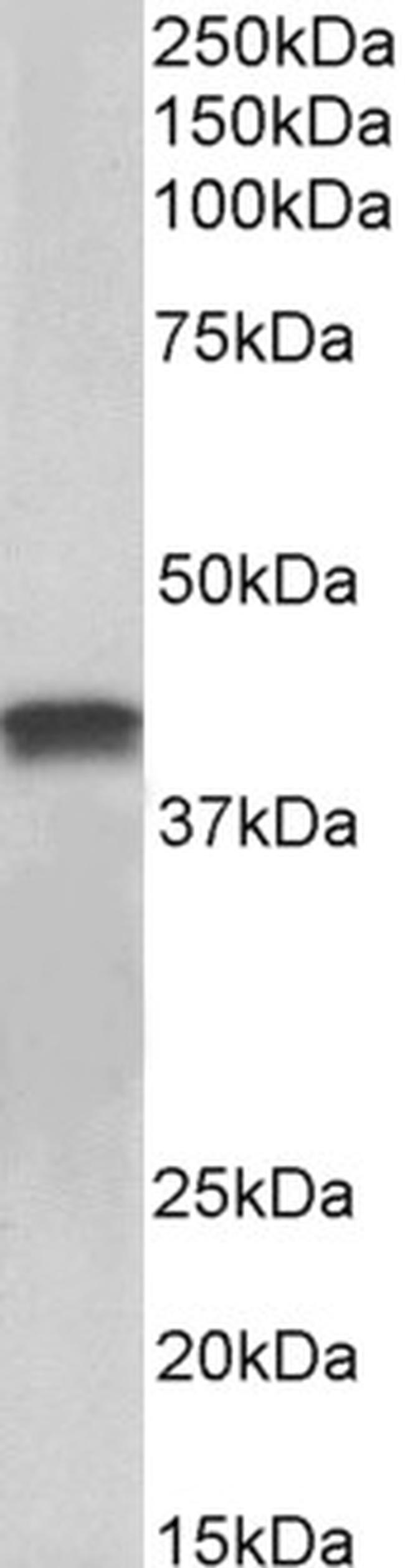 Cardiac Troponin T Antibody in Western Blot (WB)