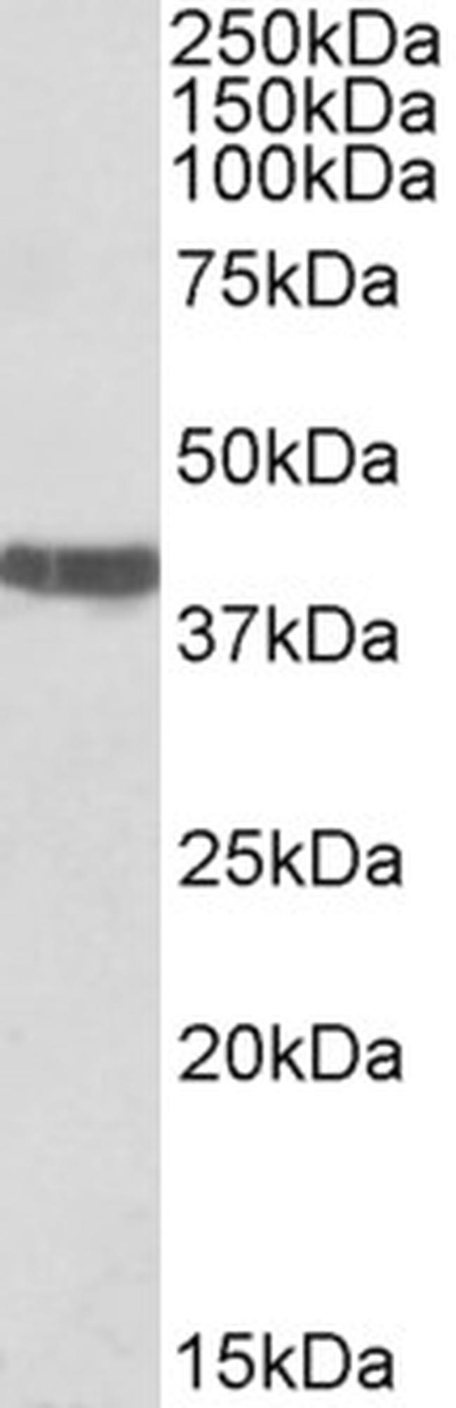 Cardiac Troponin T Antibody in Western Blot (WB)