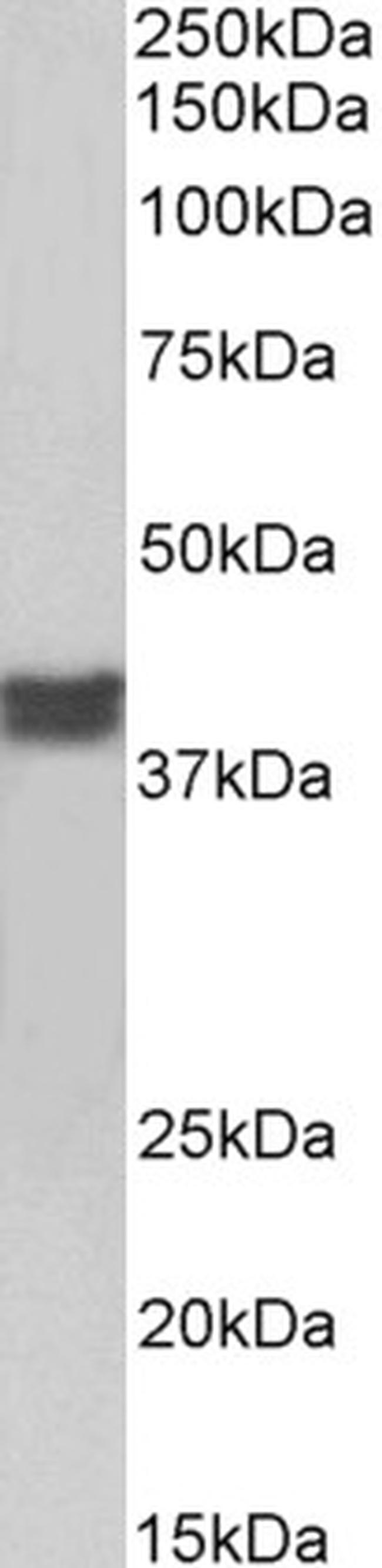 Cardiac Troponin T Antibody in Western Blot (WB)