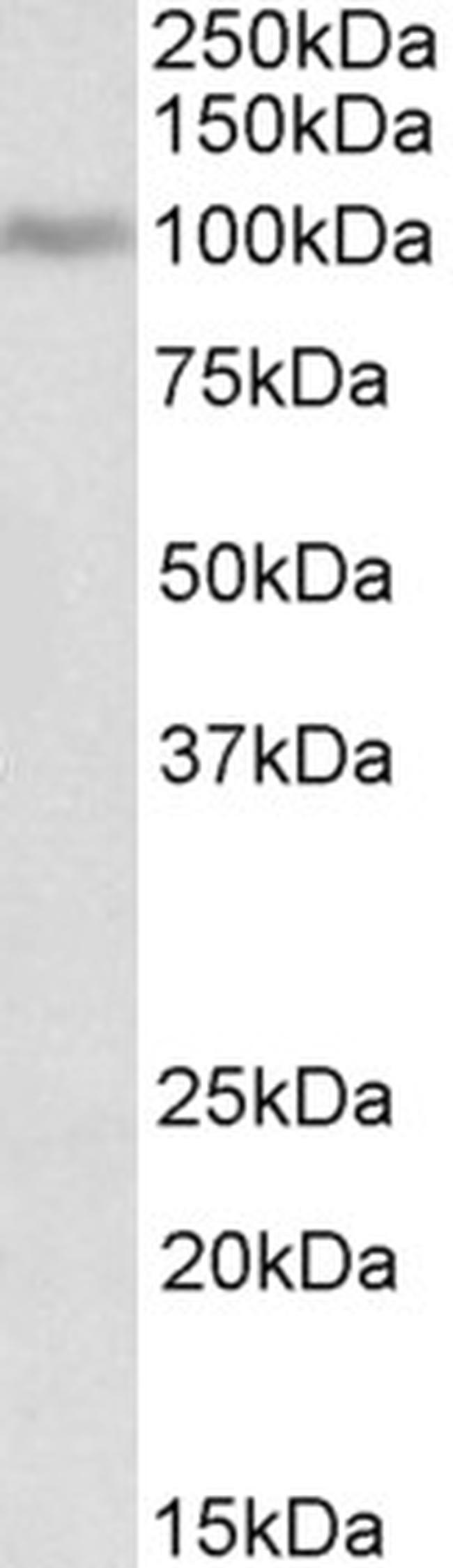 Periostin Antibody in Western Blot (WB)