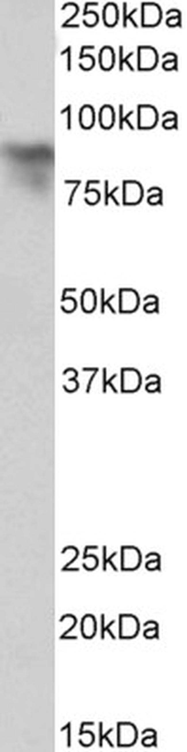 Periostin Antibody in Western Blot (WB)