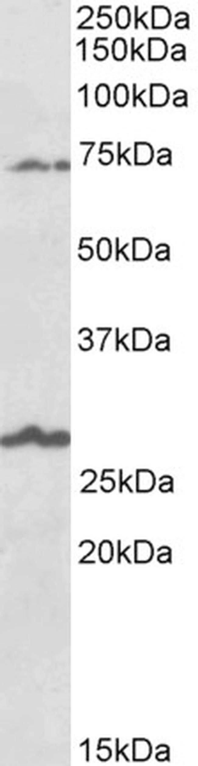 SLC6A12 Antibody in Western Blot (WB)