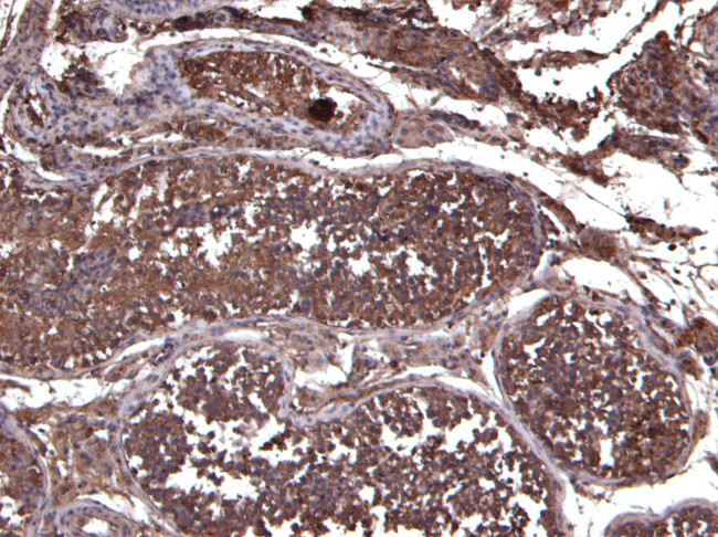 LIF Antibody in Immunohistochemistry (Paraffin) (IHC (P))