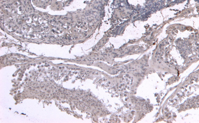 LIF Antibody in Immunohistochemistry (Paraffin) (IHC (P))