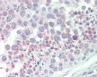 IGFBP-1 Antibody in Immunohistochemistry (Paraffin) (IHC (P))