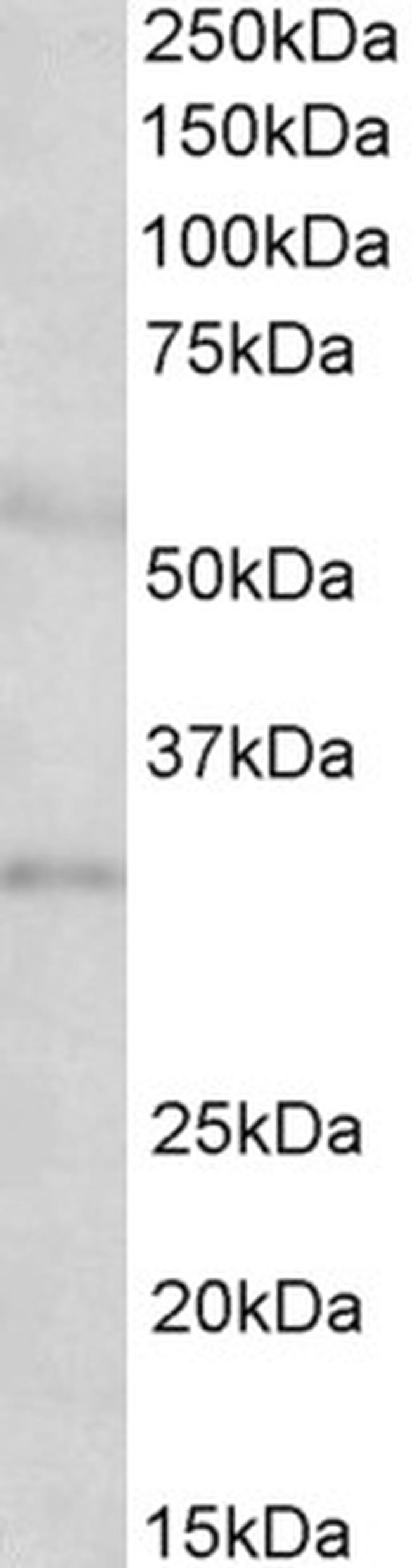 IGFBP-1 Antibody in Western Blot (WB)