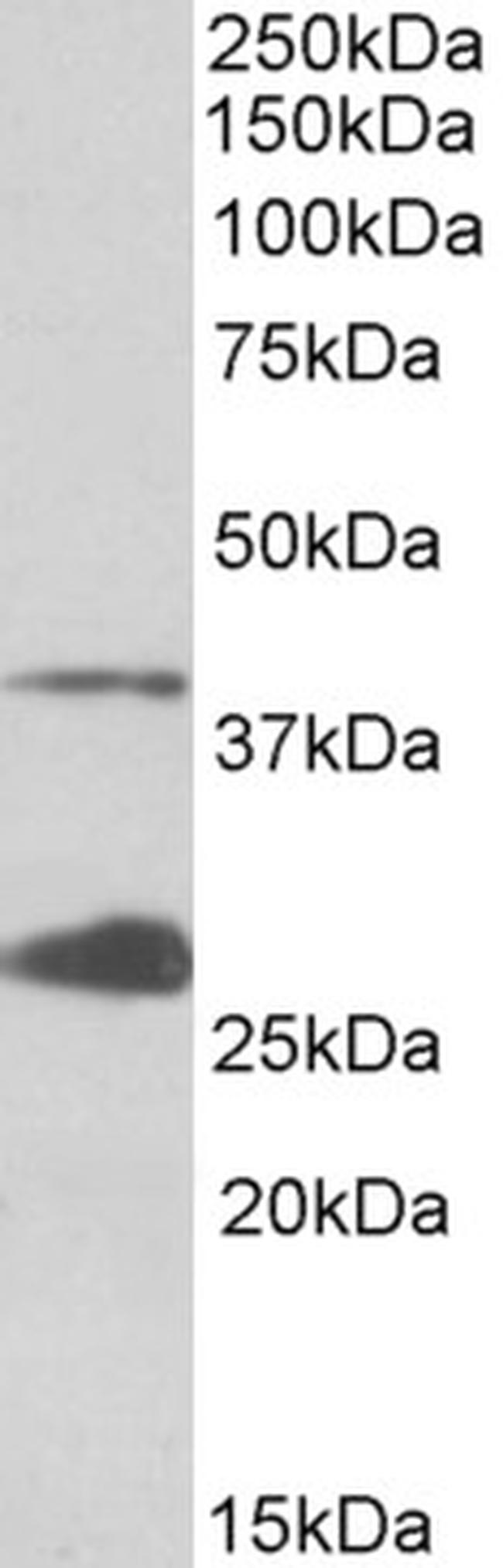 UROD Antibody in Western Blot (WB)