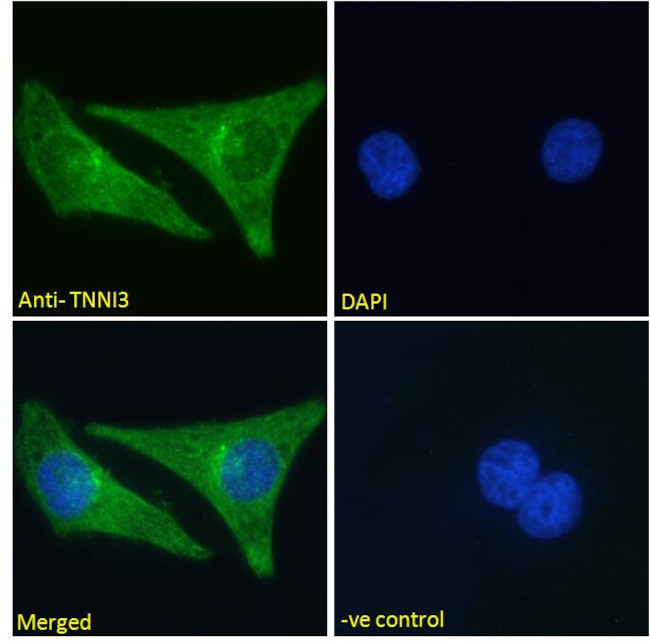 Cardiac Troponin I Antibody in Immunocytochemistry (ICC/IF)