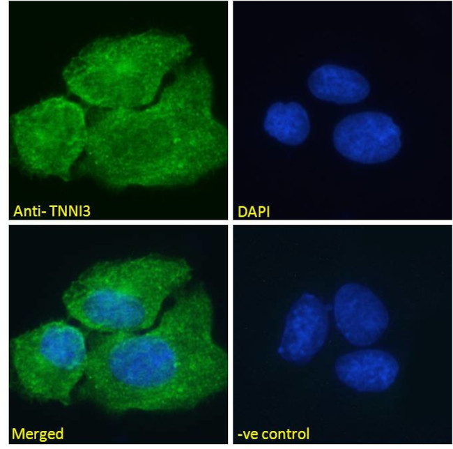 Cardiac Troponin I Antibody in Immunocytochemistry (ICC/IF)