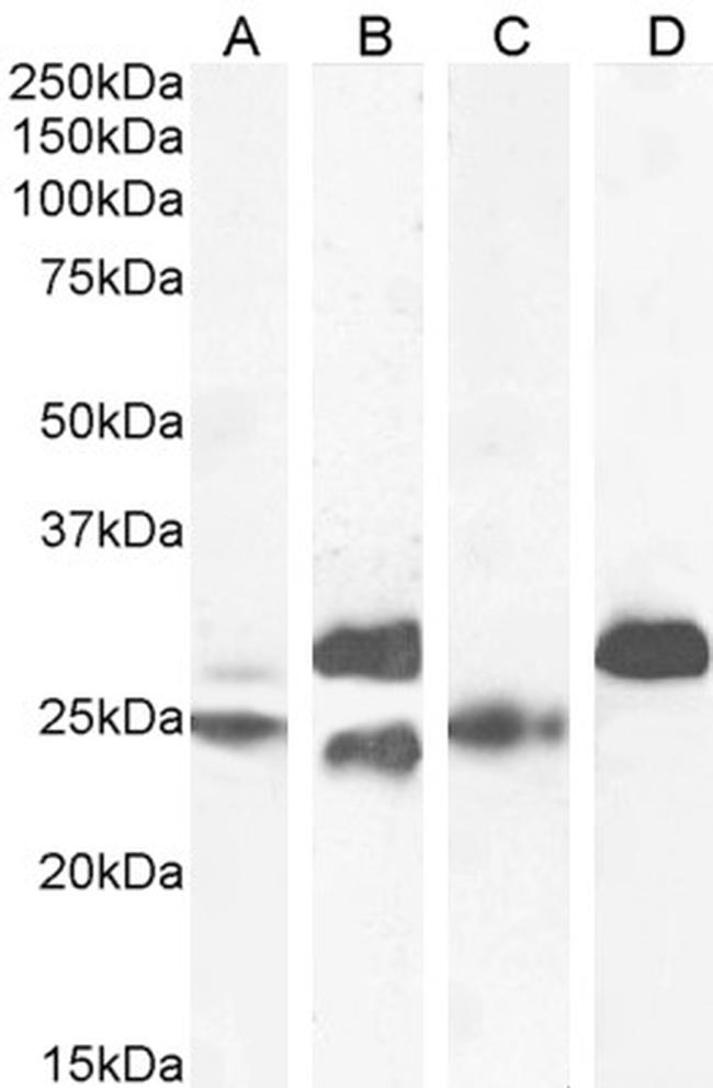 Cardiac Troponin I Antibody in Western Blot (WB)