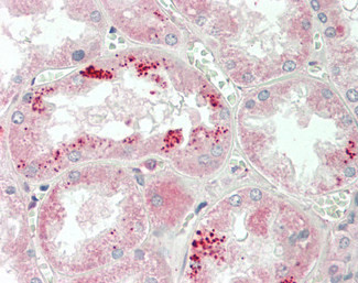 ApoA1 Antibody in Immunohistochemistry (Paraffin) (IHC (P))