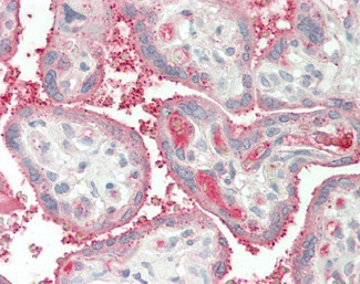 ApoA1 Antibody in Immunohistochemistry (Paraffin) (IHC (P))