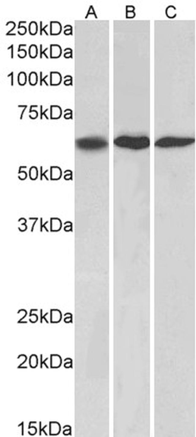 MMP14 Antibody in Western Blot (WB)