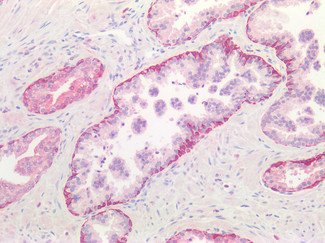 Cathepsin B Antibody in Immunohistochemistry (Paraffin) (IHC (P))