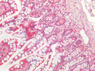 Cathepsin B Antibody in Immunohistochemistry (Paraffin) (IHC (P))