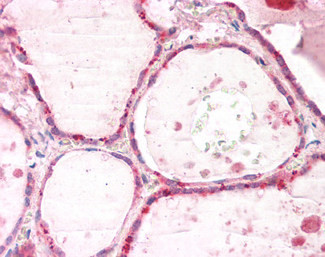 GNAI2 Antibody in Immunohistochemistry (Paraffin) (IHC (P))