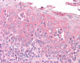 GNAI2 Antibody in Immunohistochemistry (Paraffin) (IHC (P))