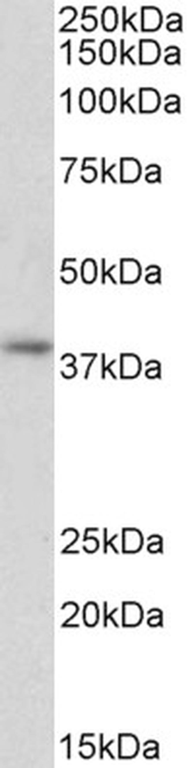 GNAI2 Antibody in Western Blot (WB)