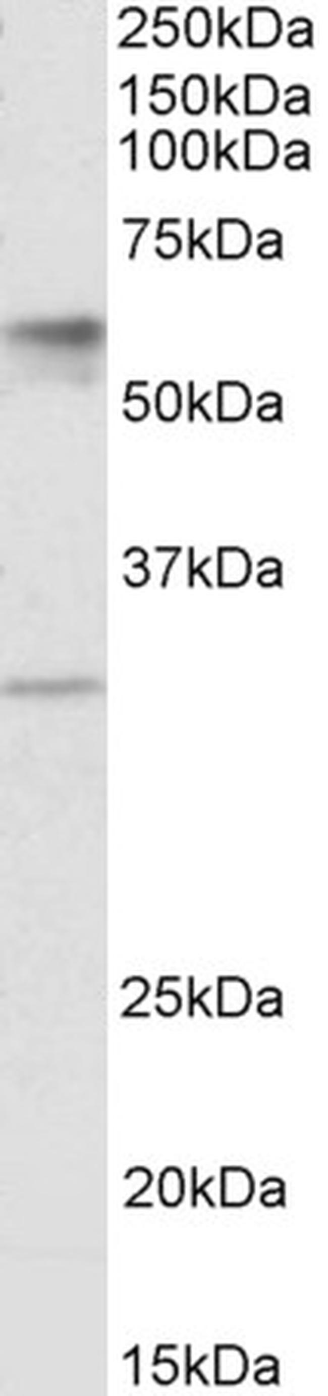 SLC17A5 Antibody in Western Blot (WB)