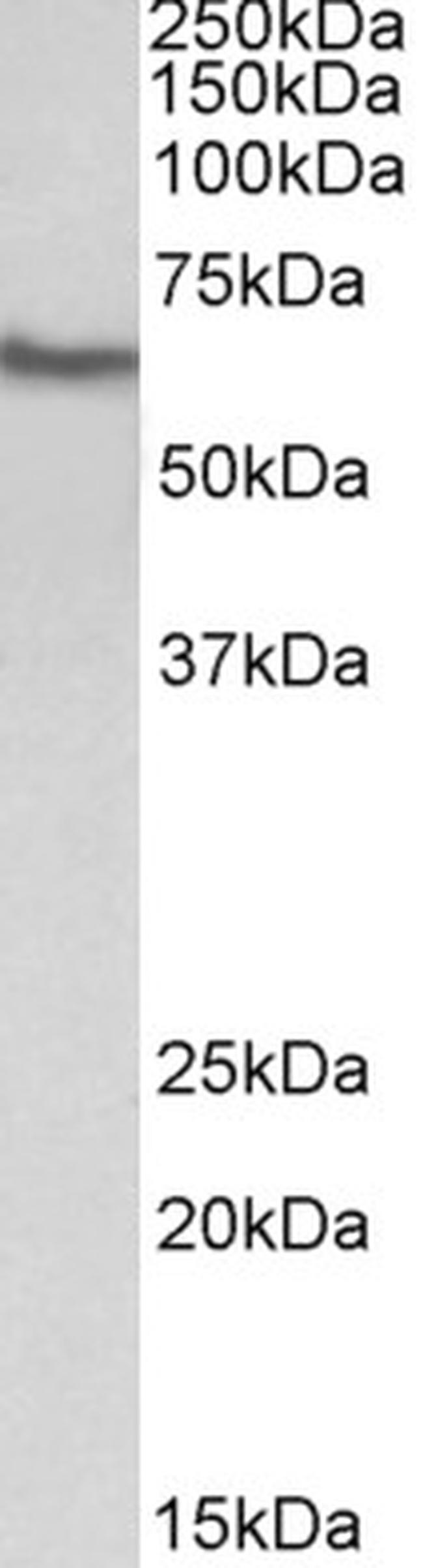 GGT1 Antibody in Western Blot (WB)