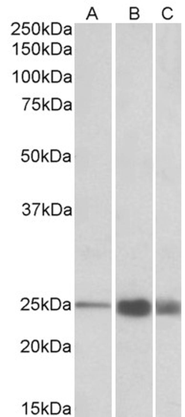 TNNI2 Antibody in Western Blot (WB)