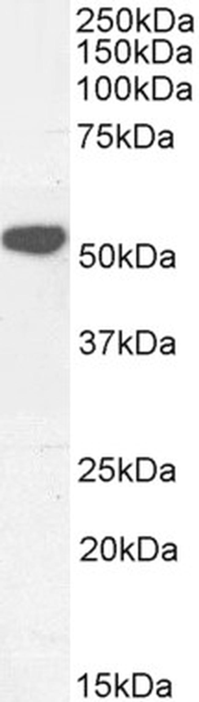 KATNAL2 Antibody in Western Blot (WB)