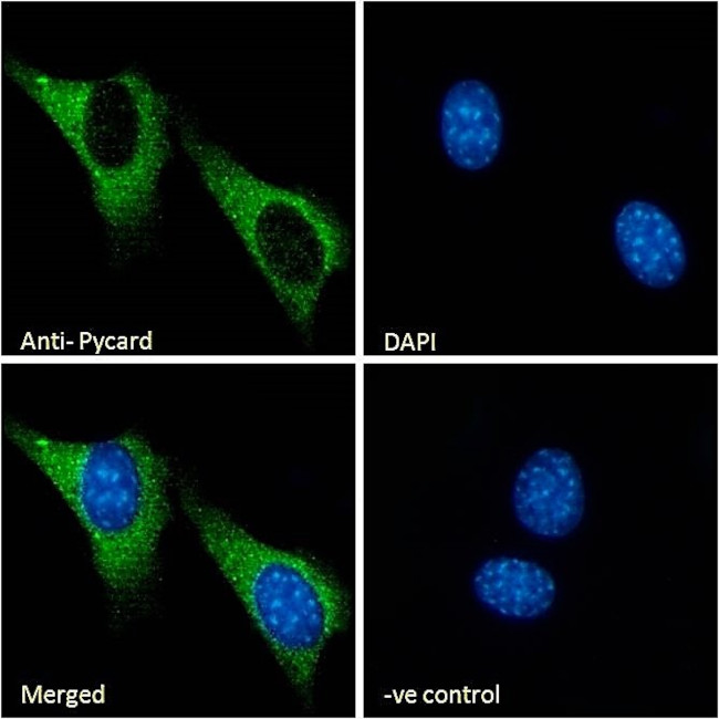 PYCARD Antibody in Immunocytochemistry (ICC/IF)