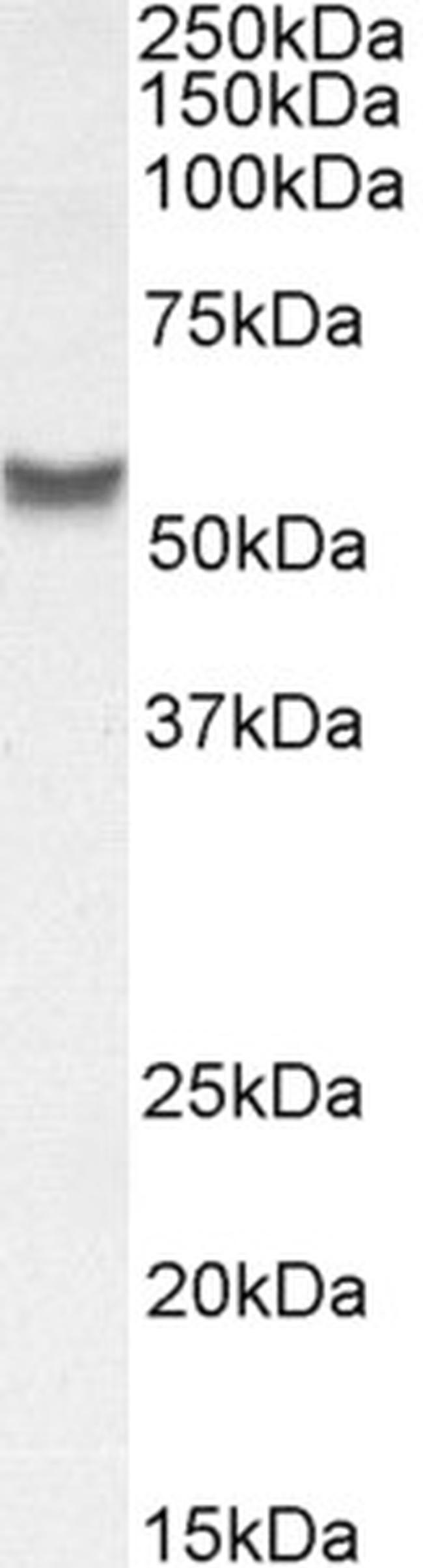 YLAT2 Antibody in Western Blot (WB)