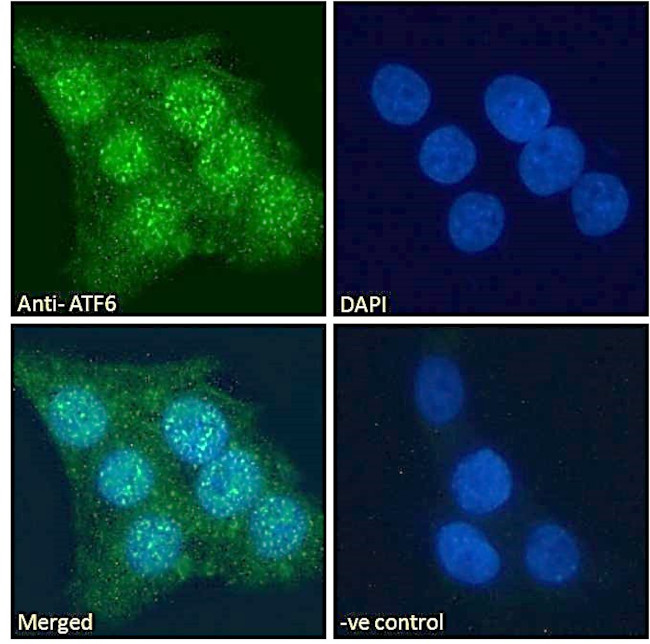 ATF6 Antibody in Immunocytochemistry (ICC/IF)