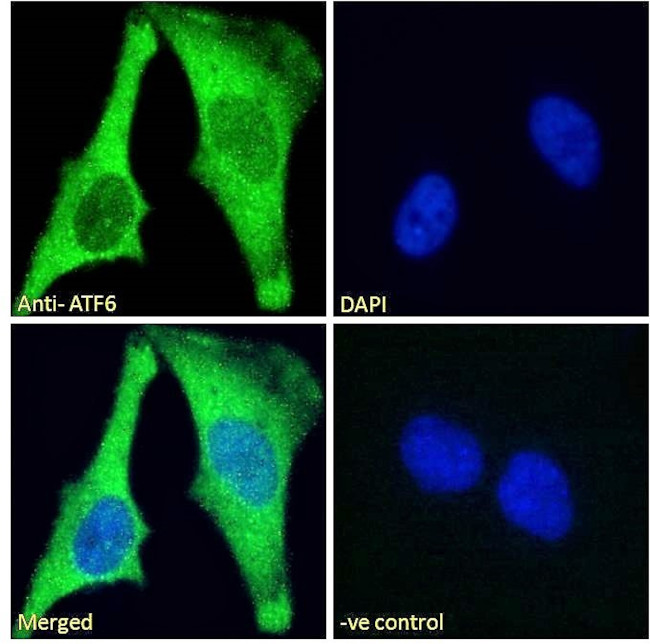 ATF6 Antibody in Immunocytochemistry (ICC/IF)