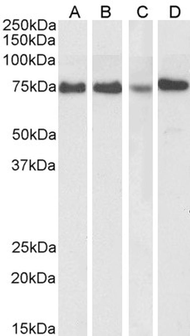 ATF6 Antibody in Western Blot (WB)