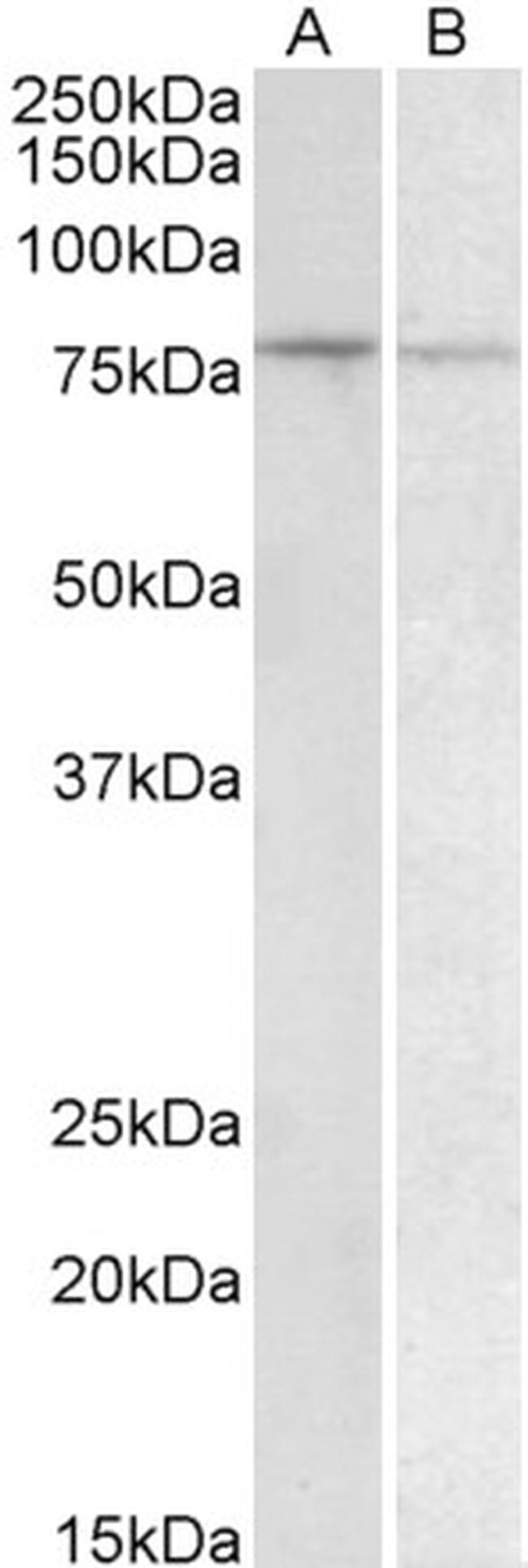 BACH1 Antibody in Western Blot (WB)