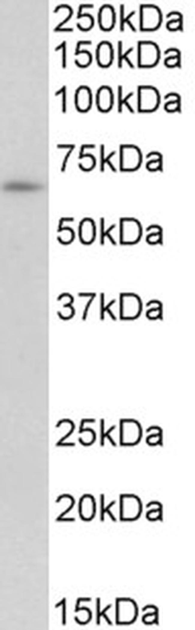 IFNAR1 Antibody in Western Blot (WB)