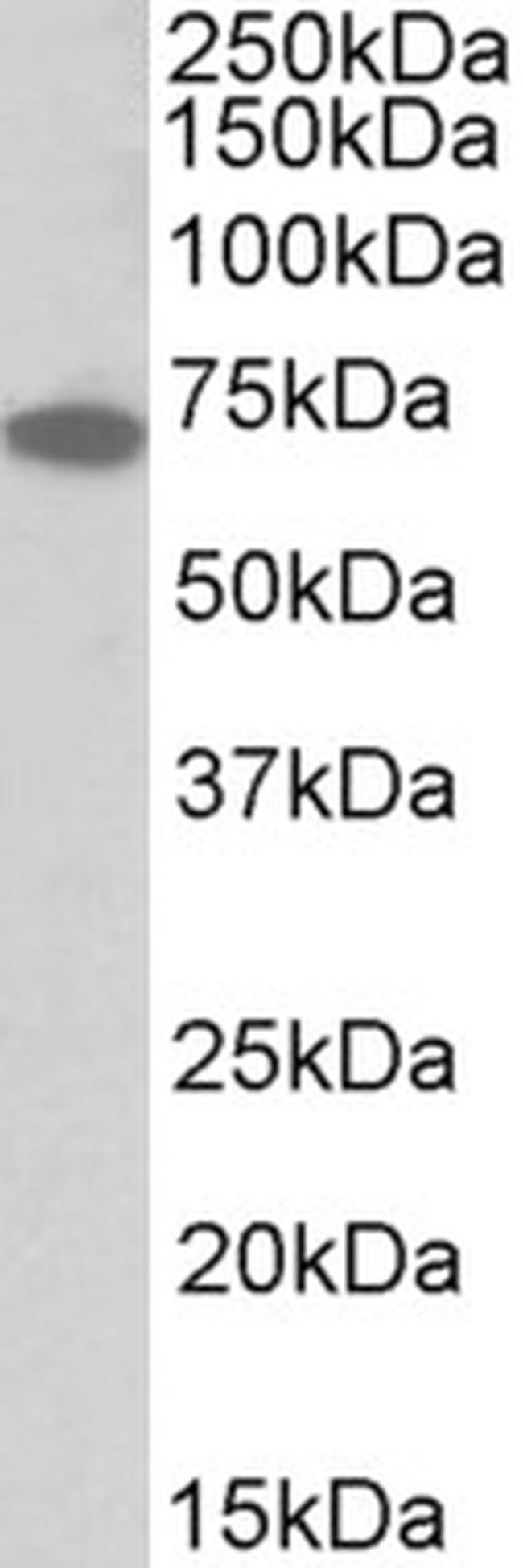 IFNGR1 (CD119) Antibody in Western Blot (WB)