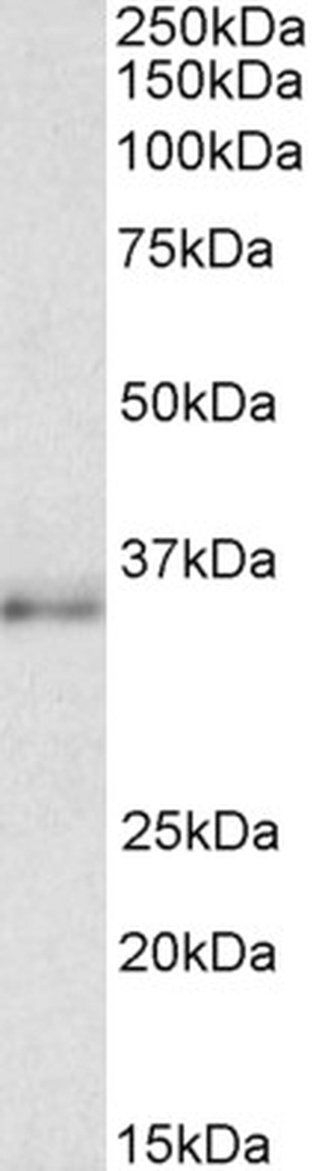 C/EBP beta Antibody in Western Blot (WB)