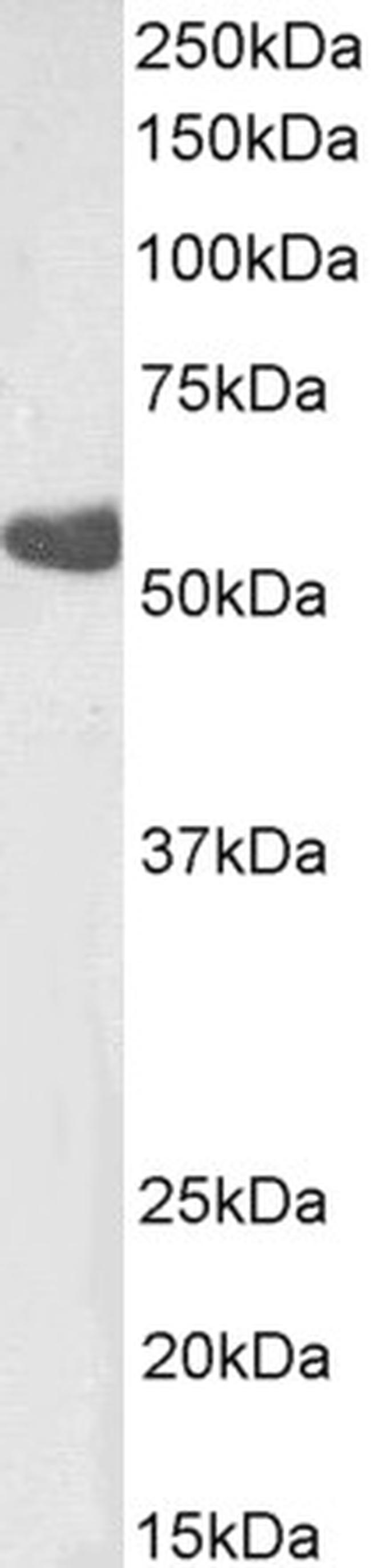 TBXA2R beta Antibody in Western Blot (WB)