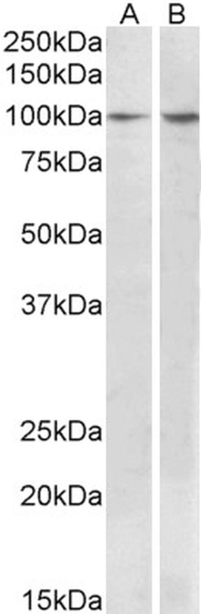 p130Cas Antibody in Western Blot (WB)