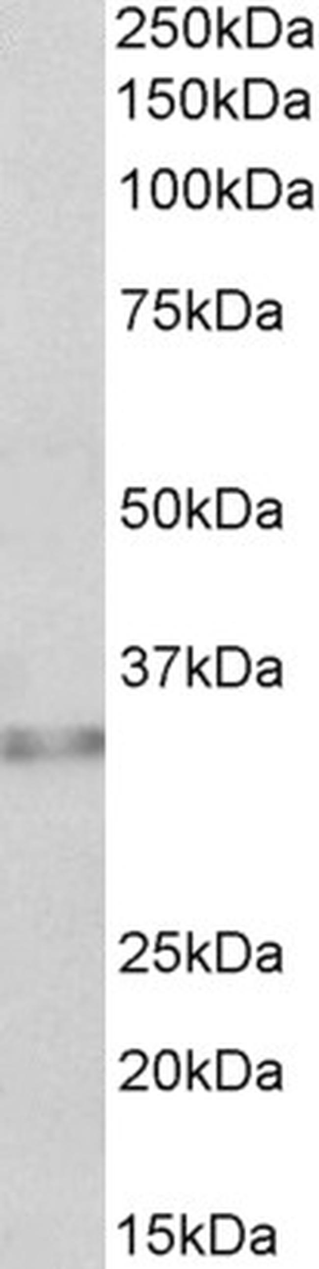 Caspase 6 Antibody in Western Blot (WB)