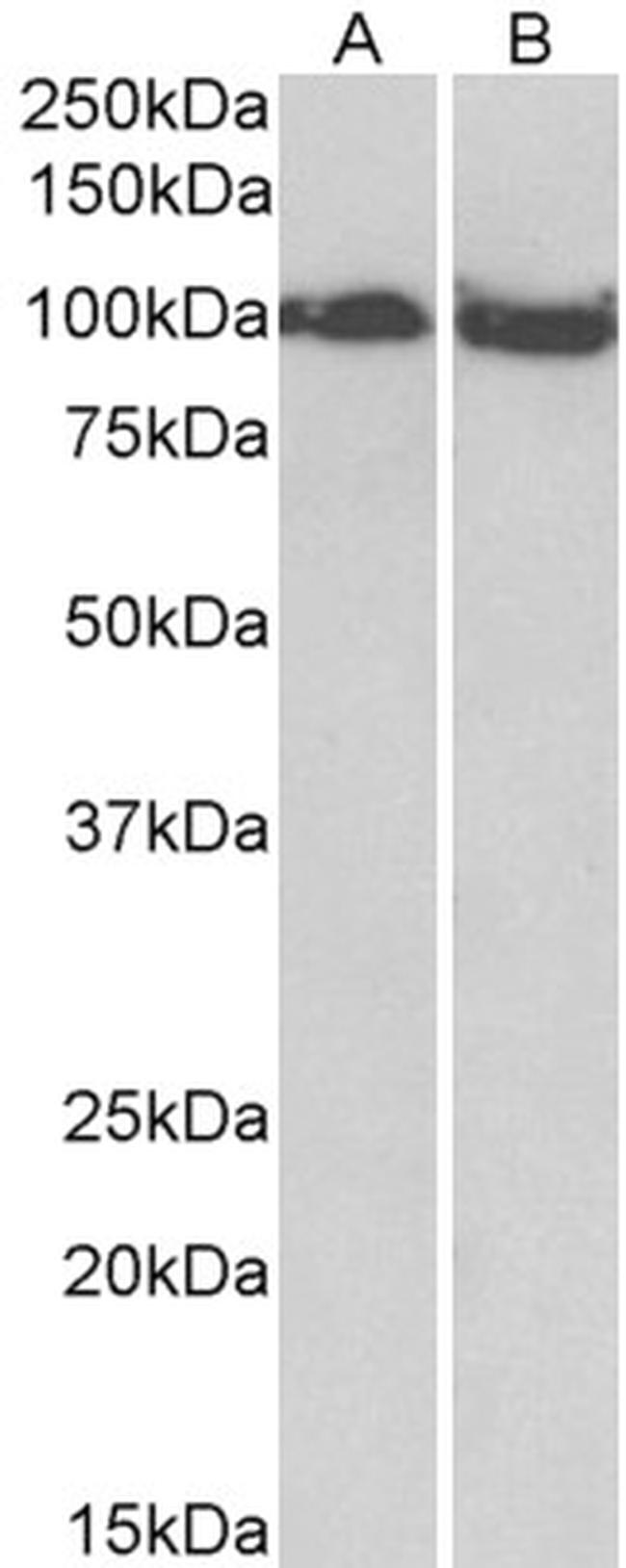 CLOCK Antibody in Western Blot (WB)