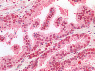 CREB Antibody in Immunohistochemistry (Paraffin) (IHC (P))