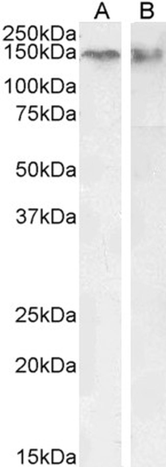 CTCF Antibody in Western Blot (WB)