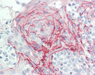 HOXC6 Antibody in Immunohistochemistry (Paraffin) (IHC (P))