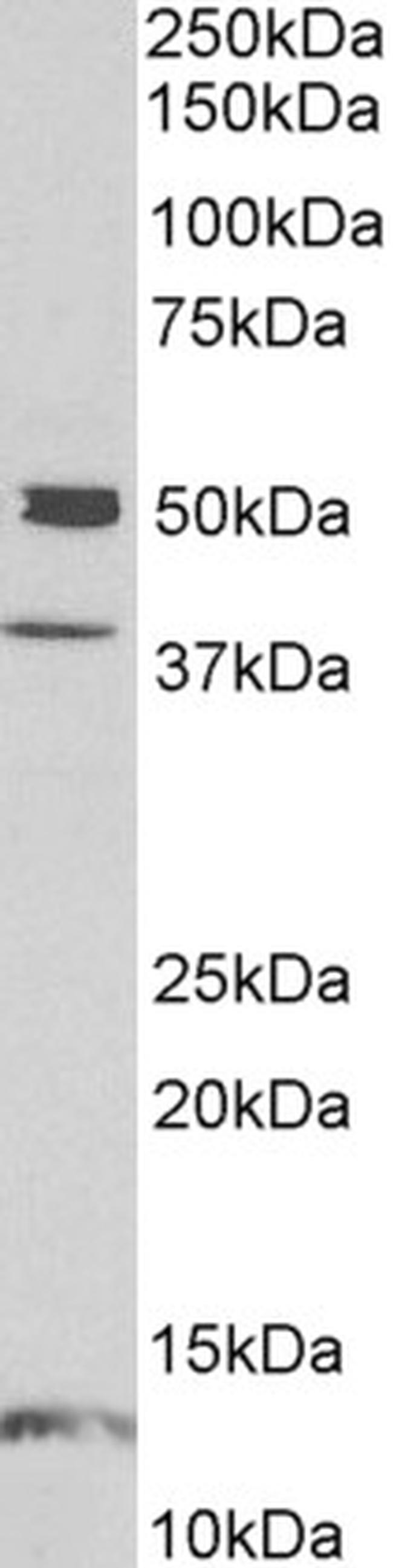 NPTX1 Antibody in Western Blot (WB)