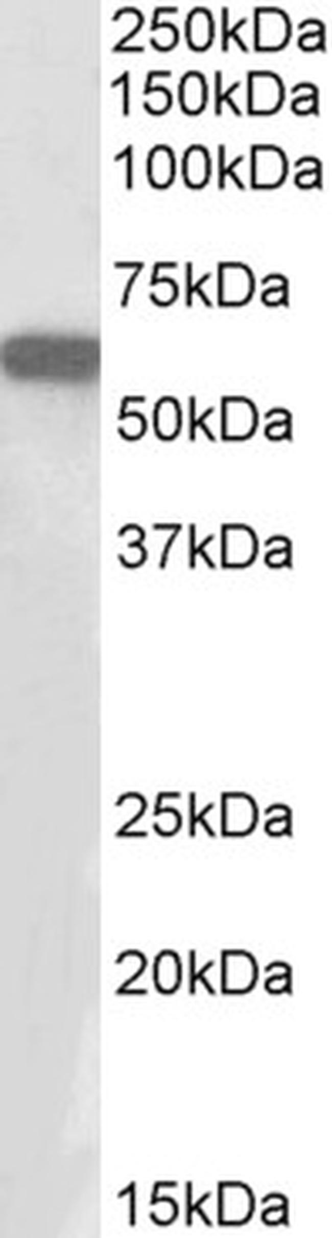 E2F1 Antibody in Western Blot (WB)