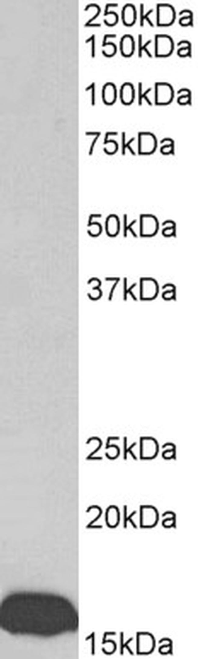 Transthyretin Antibody in Western Blot (WB)