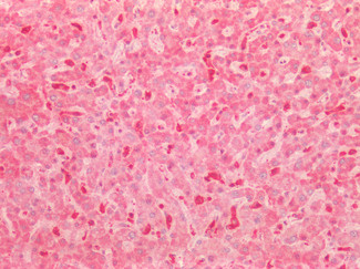 Kininogen 1 Antibody in Immunohistochemistry (Paraffin) (IHC (P))