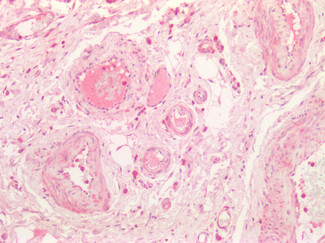 Kininogen 1 Antibody in Immunohistochemistry (Paraffin) (IHC (P))