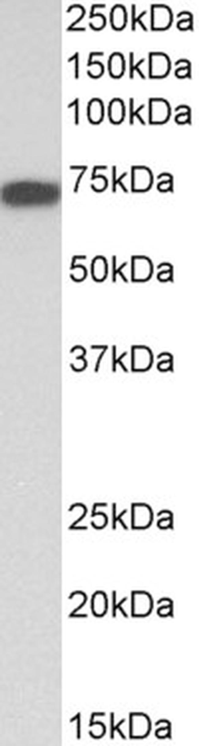 Kininogen 1 Antibody in Western Blot (WB)