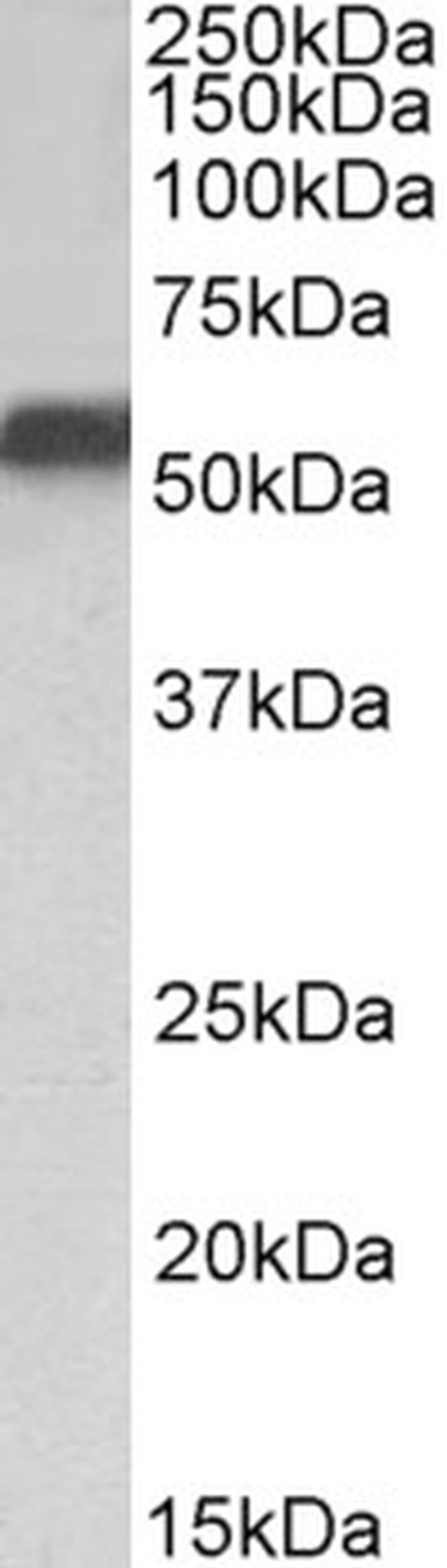 NR5A2 Antibody in Western Blot (WB)