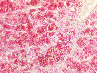 SR-BI Antibody in Immunohistochemistry (Paraffin) (IHC (P))